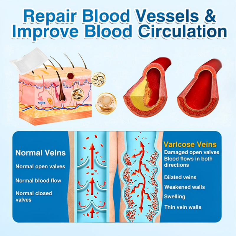 🇬🇧👨⚕️🌟🏅QIAWI® VeinRepair Microneedle Patch Roll⚡Instant Relief, Long-Term Results