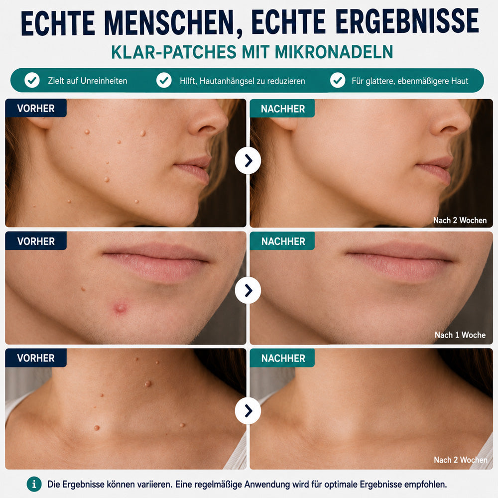 🩵Effektive botanische Mikronadel-Pflaster zur Entfernung von Hautanhängseln