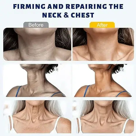 Alisanda™ Instant Neck Lift Cream