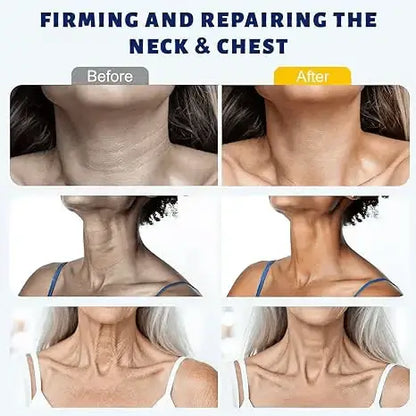 Alisanda™ Instant Neck Lift Cream