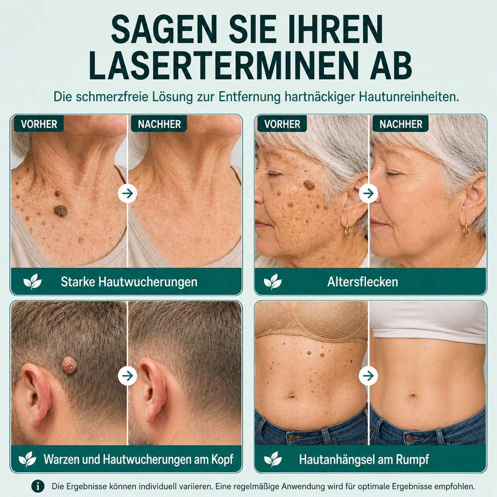 🩵Effektive botanische Mikronadel-Pflaster zur Entfernung von Hautanhängseln
