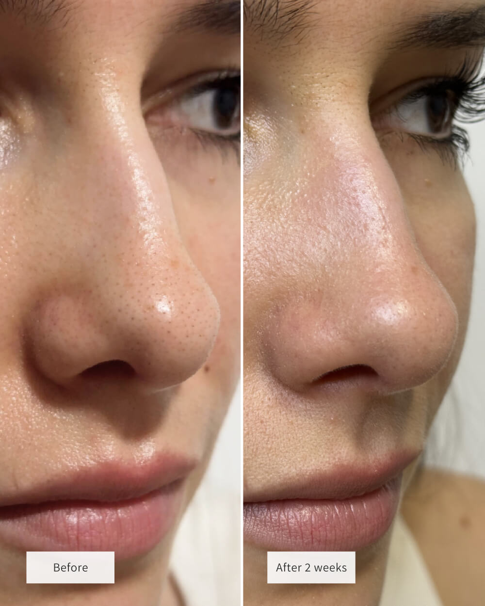 🧄🌿GEZRIA®Choose Your BundleDeep-Clean Nose Strips – Removes Blackheads & Tightens Pores