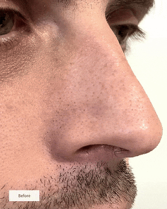 🧄🌿GEZRIA®Choose Your BundleDeep-Clean Nose Strips – Removes Blackheads & Tightens Pores